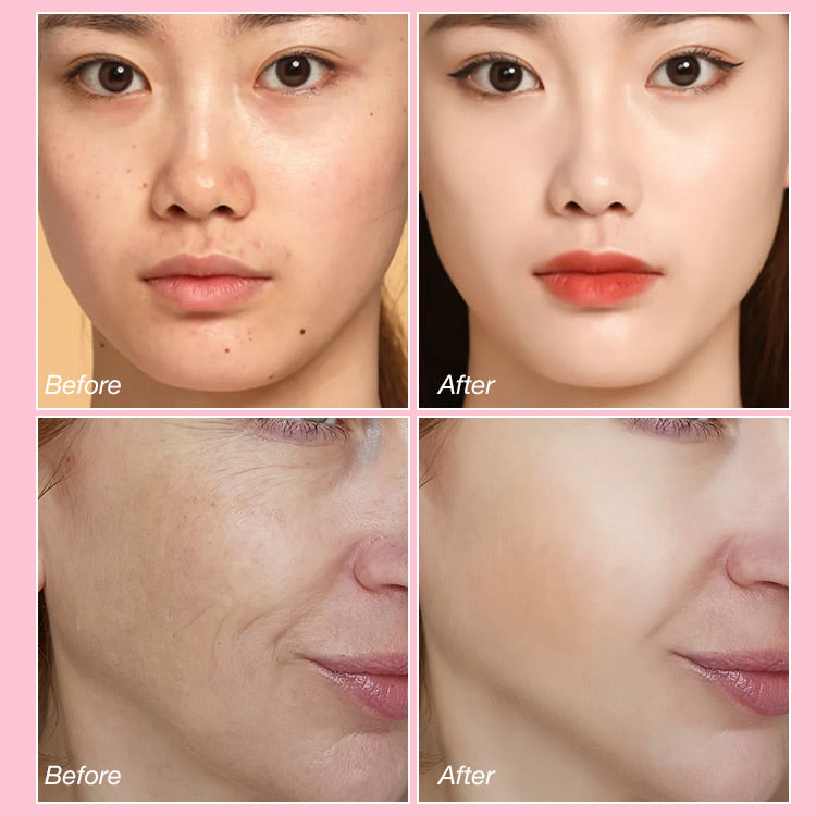 Facial Beauty Scrape Therapy Cupping Tool
