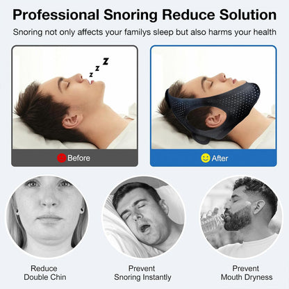 Anti Snoring Chin Strap - Avoid sleep apnea and prevent mouth breathing - Simple and Effective Stop Snoring Solution, Enjoy a Nice Evening.